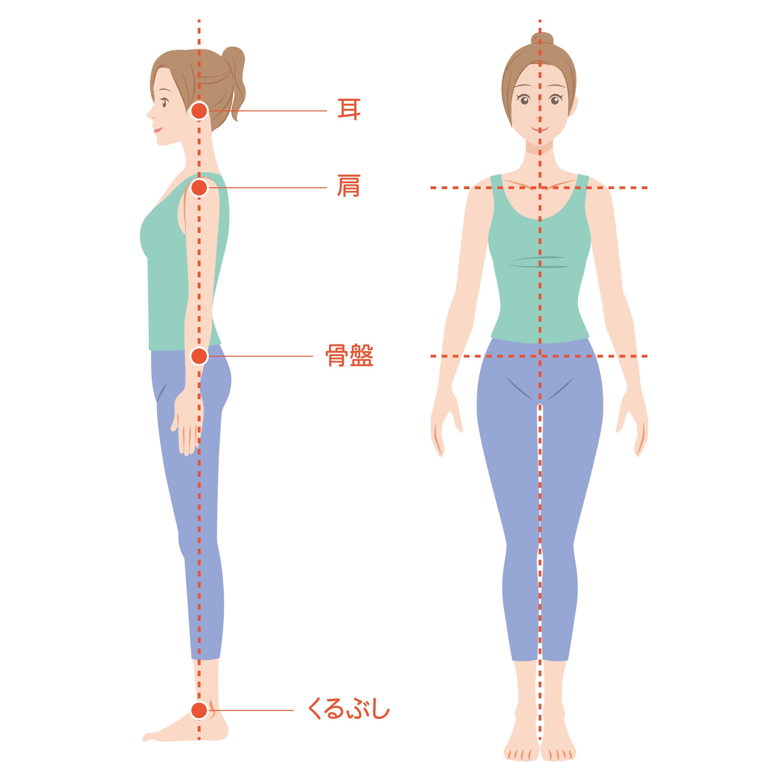 ガニ股とは？O脚との違いや見分け方・骨盤の歪みと歩き方の改善法を徹底解説