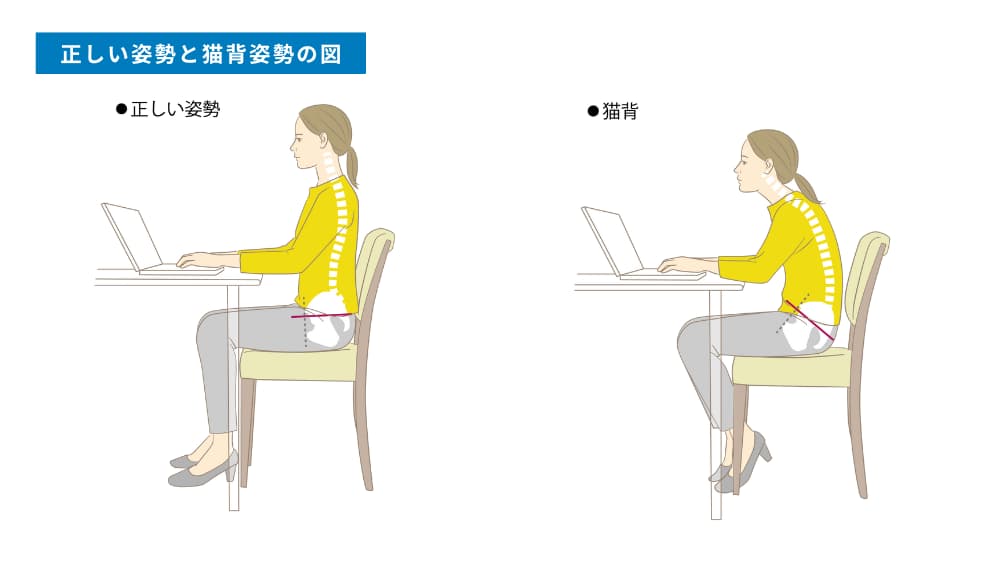 猫背を改善する方法とは？自宅でできるストレッチと筋トレを徹底解説